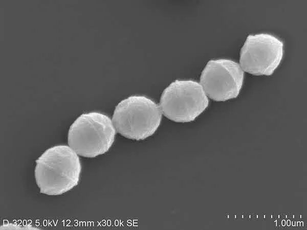 「劇症型溶血性レンサ球菌感染症について」